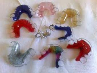 apparecchio_denti