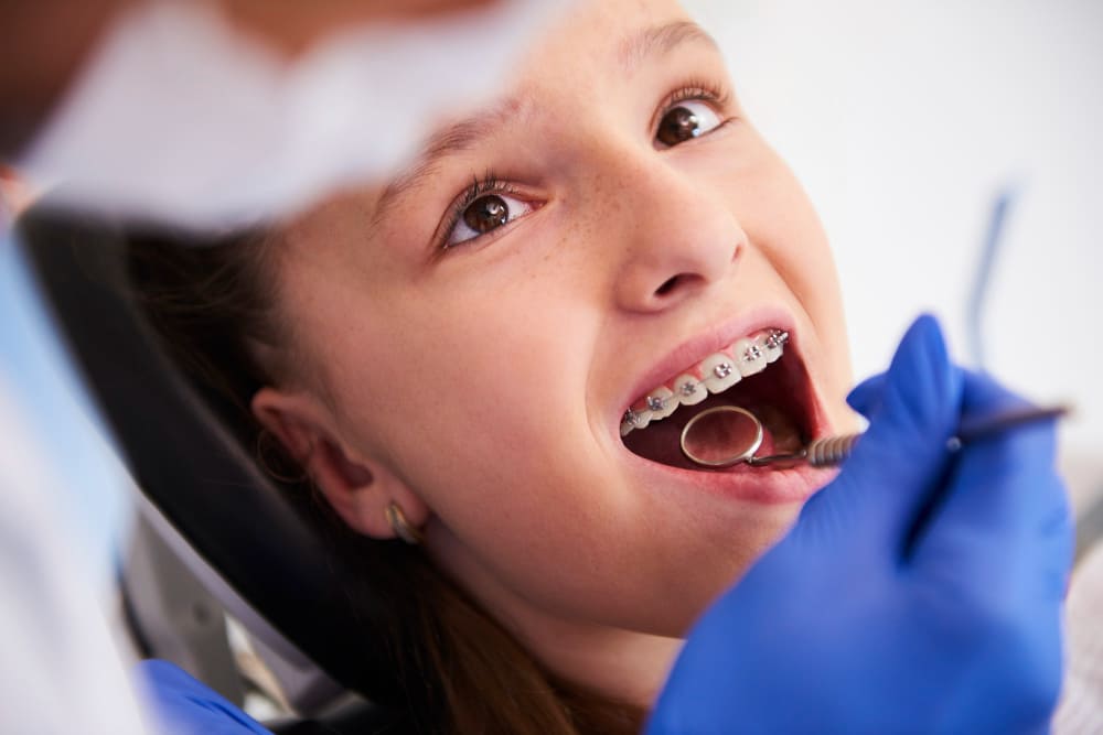 apparecchio denti per bambini